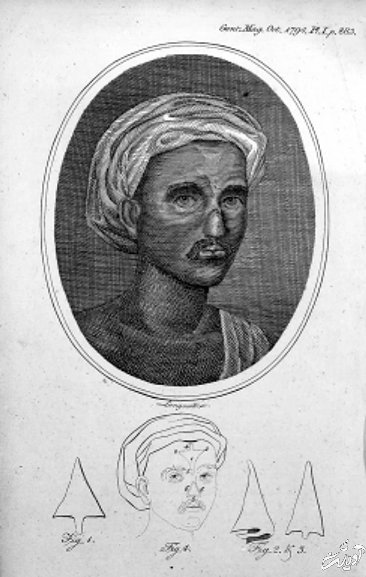 ۱۱ حقیقتی که ثابت می کند عمل های زیبایی از گذشته وجود داشتند